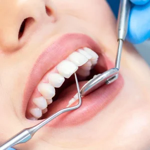 Beyond the Chair: Personalised Approaches to Empowering Dental Health