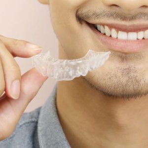 Invisalign and the Art of Digital Smile Crafting